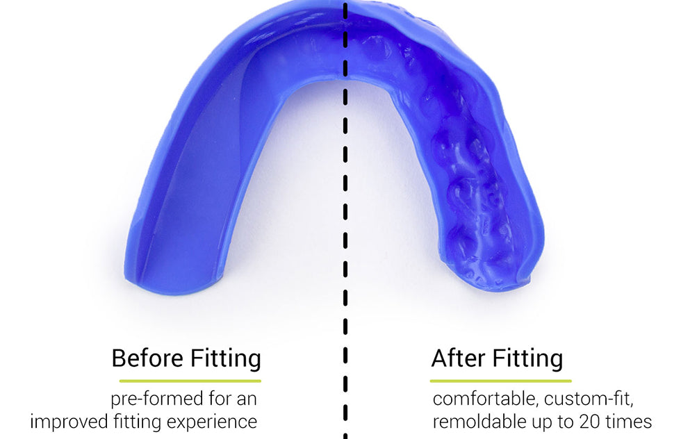 SISU 3D Custom Fit Mouthguard